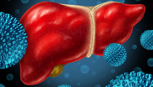 Hepatitis Liver Infection